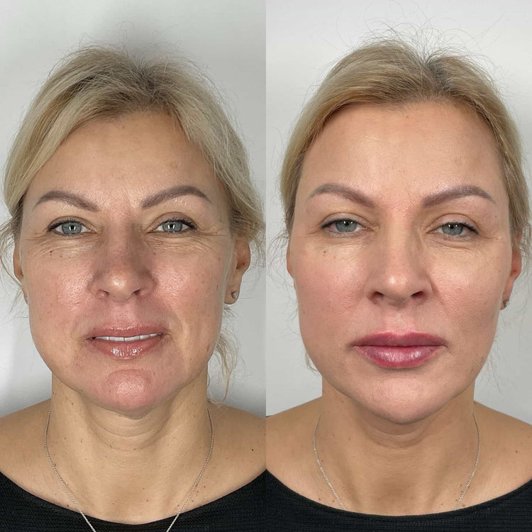 Skin Booster For Dull Complexion in Morden, Surrey